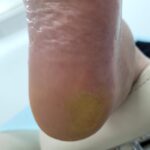 pedicure
