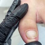 Hygienic pedicure